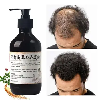 Saç Dökülmesi Tedavisi Şampuan saç bakım şampuanı Bar Zencefil Inceltme Polygonum Derisi Büyüme 300 ml Şampuan Tedaviler Saç S1Z8